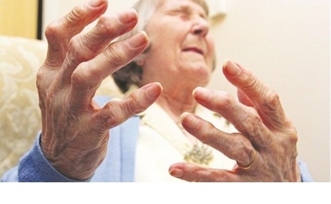 Điều trị viêm khớp dạng thấp