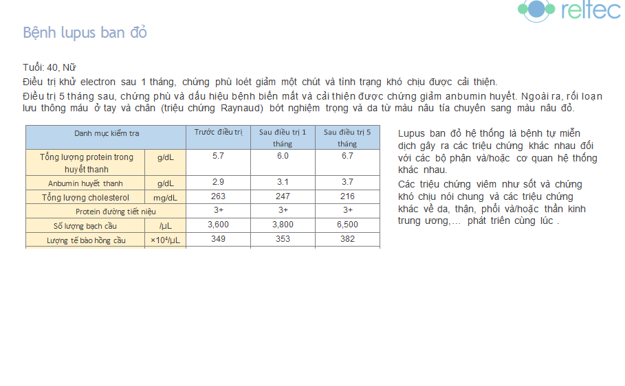Điều trị Lupus ban đỏ